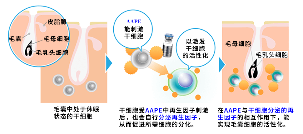 HARG毛发再生疗法